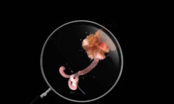 Los gusanos zombies están desapareciendo y eso no es nada buena noticia